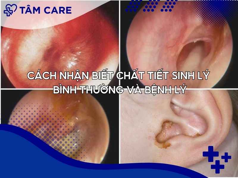 Cách nhận biết chất tiết sinh lý bình thường và bệnh lý