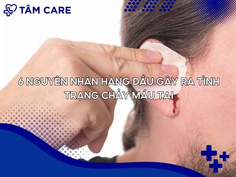 6 Nguyên nhân hàng đầu gây ra tình trạng chảy máu tai