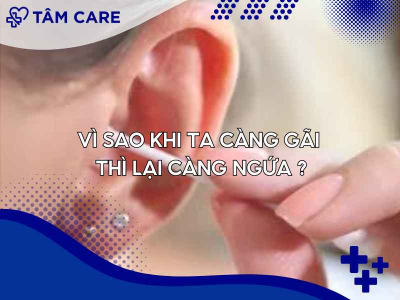 Giải thích nguyên do vì sao càng gãi lại càng ngứa