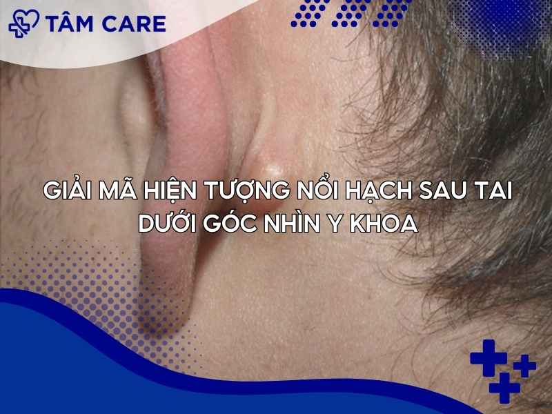Giải mã hiện tượng nổi hạch sau tai dưới góc nhìn y khoa