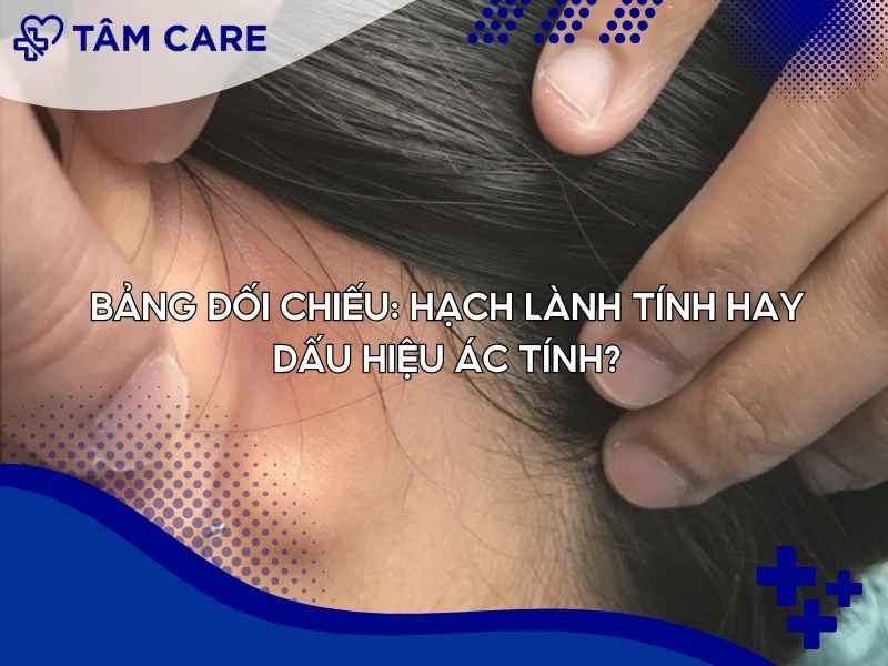 Bảng đối chiếu: Hạch lành tính hay dấu hiệu ác tính?