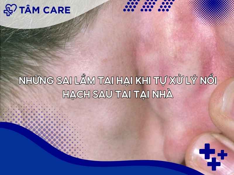 Những sai lầm tai hại khi tự xử lý nổi hạch sau tai tại nhà