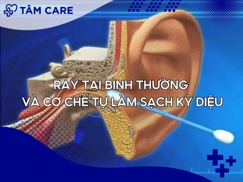 Ráy tai bình thường và cơ chế tự làm sạch kỳ diệu