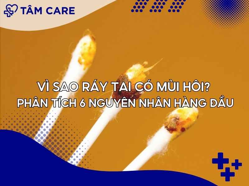Vì sao ráy tai có mùi hôi? Phân tích 6 nguyên nhân hàng đầu