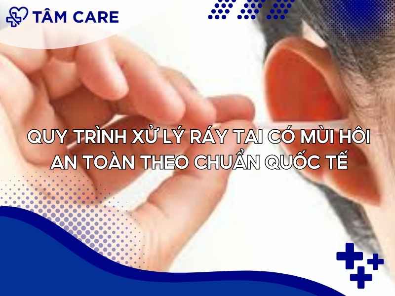 Quy trình xử lý ráy tai có mùi hôi an toàn theo chuẩn quốc tế