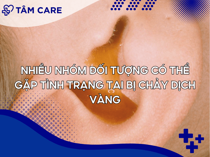 Nhiều nhóm đối tượng có thể gặp tình trạng tai bị chảy dịch vàng