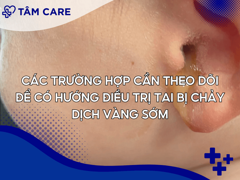 Các trường hợp cần theo dõi để có hướng điều trị tai bị chảy dịch vàng sớm