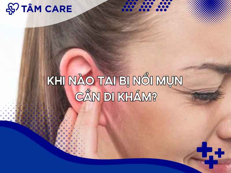 Cần đi khám ngay khi tai bị nổi mụn với các dấu hiệu sau