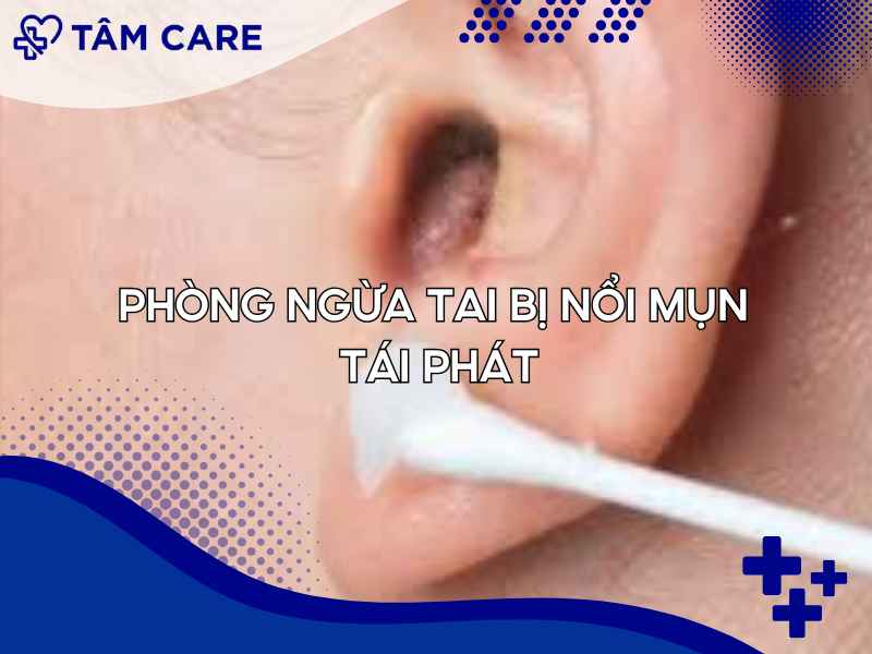 Phòng ngừa tai bị nổi mụn để tránh xuất hiện và tái phát