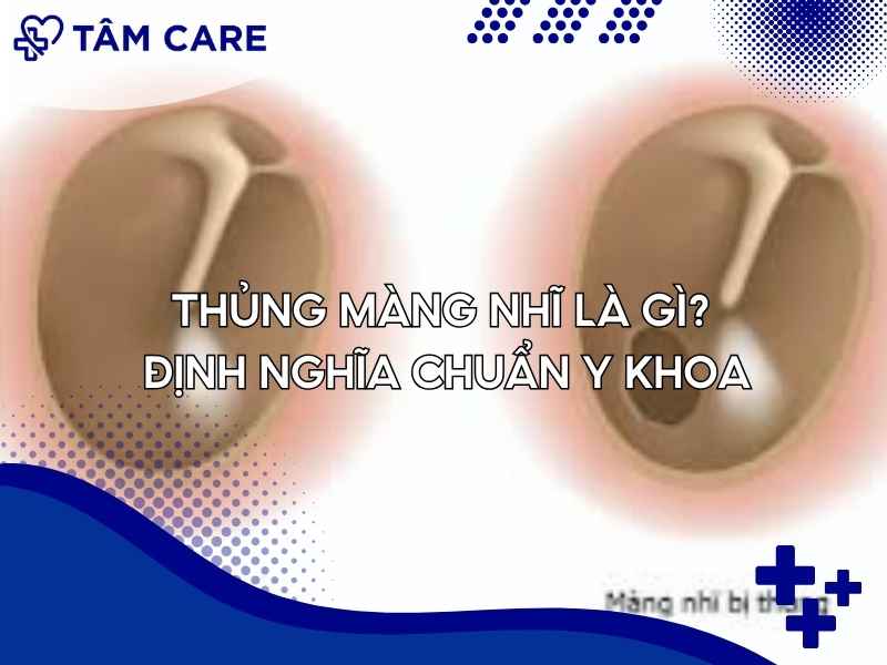 Thủng màng nhĩ là gì? Định nghĩa chuẩn y khoa