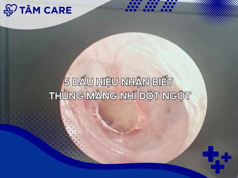 5 Dấu hiệu nhận biết thủng màng nhĩ đột ngột