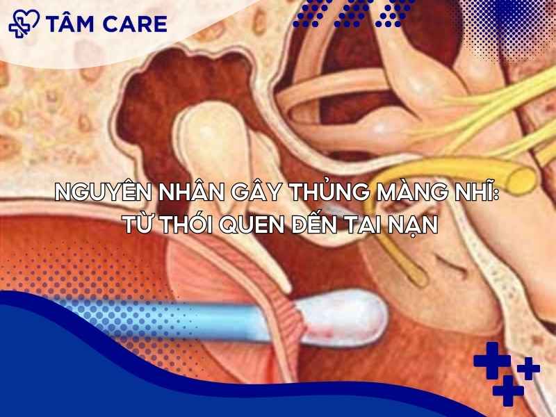 Nguyên nhân gây thủng màng nhĩ: Từ thói quen đến tai nạn