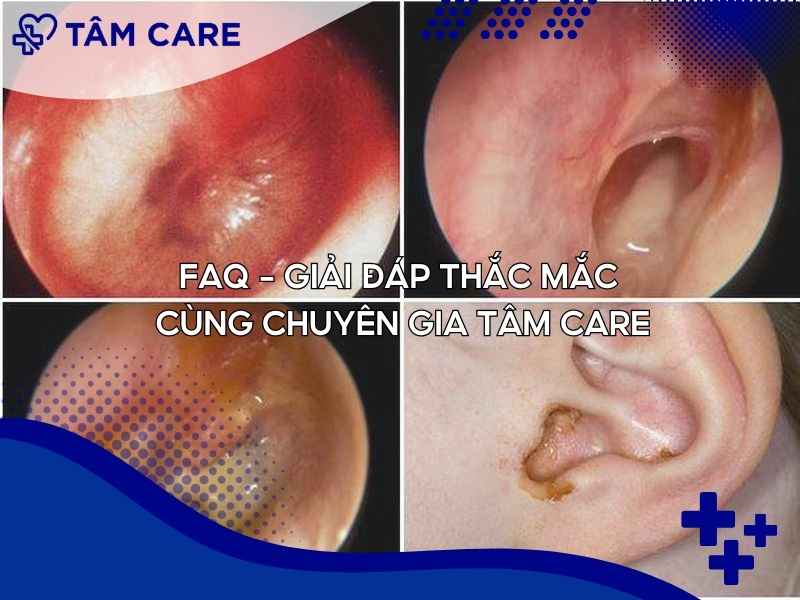 FAQ - Giải đáp thắc mắc cùng chuyên gia Tâm Care