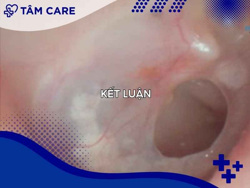 Kết luận