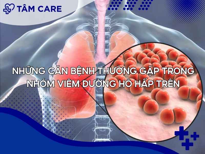Những căn bệnh thường gặp trong nhóm viêm đường hô hấp trên