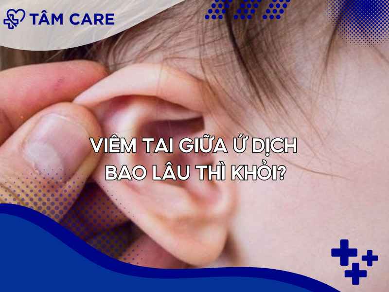 Thời gian hồi phục không có con số cụ thể