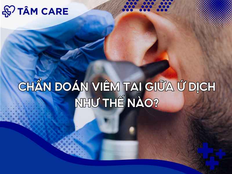 Các phương pháp chẩn đoán viêm tai giữa ứ dịch