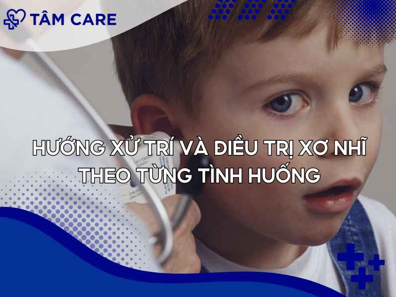 Hướng xử trí và điều trị xơ nhĩ theo từng tình huống