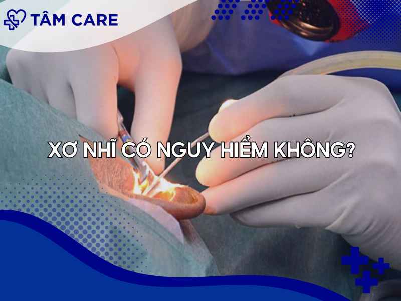 Xơ nhĩ đáng lo nhưng tùy theo mức độ
